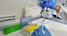 Aggiornamento Coronavirus 19/7. Nel modenese 901 nuovi casi, in Emilia-Romagna 5.379 e 22 decessi