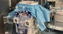 Trapianto di fegato, primo intervento con la nuova apparecchiatura progettata a Mirandola