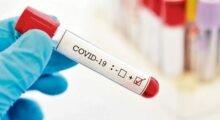 Coronavirus, l’aggiornamento di Ausl e Aou Modena: in aumento contagi e ricoveri