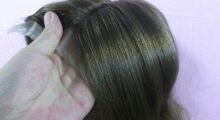 Alopecia areata grave, al via le domande di contributo per l’acquisto della parrucca