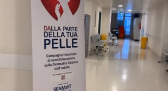 “Dalla parte della tua pelle”: tornano a Modena gli Open Day sulla dermatite atopica