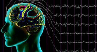 Spiando i neuroni mentre chiacchierano: la magia dell’elettroencefalografia