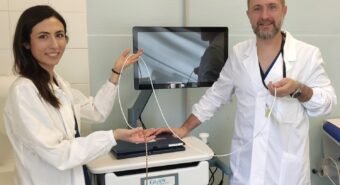 Ospedale di Carpi, per le patologie dell’esofago nuova tecnologia per diagnosi e trattamento